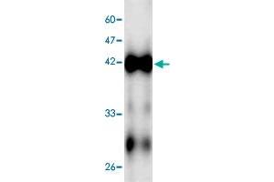 Western blot analysis in ECs2841 recombinant protein with ECs2841 monoclonal antibody, clone 5f4s6  at 1 : 1000 dilution.
