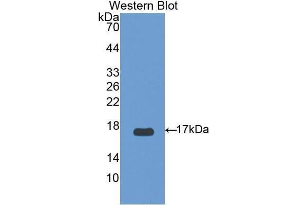 anti-Uncoupling Protein 2 (Mitochondrial, Proton Carrier) (UCP2) (AA 154-289) antibody