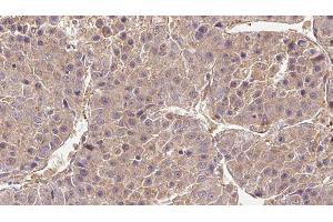 anti-Cation Channel, Sperm Associated 4 (CATSPER4) (Internal Region) antibody
