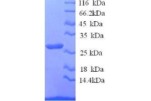 Image no. 1 for Interleukin 12 beta (IL12B) (AA 23-327), (full length) protein (His tag) (ABIN1476680)