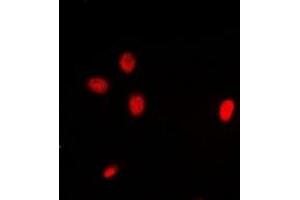 Image no. 1 for anti-Inhibitor of Growth Family, Member 3 (ING3) antibody (ABIN3198160)