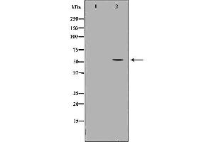 Image no. 1 for anti-Fibrinogen beta Chain (FGB) (C-Term) antibody (ABIN6261718)