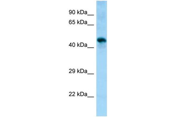 anti-Sphingomyelin Synthase 1 (SGMS1) (Middle Region) antibody