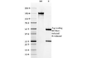 Image no. 1 for anti-Keratin 6A (KRT6A) antibody (ABIN6939867)