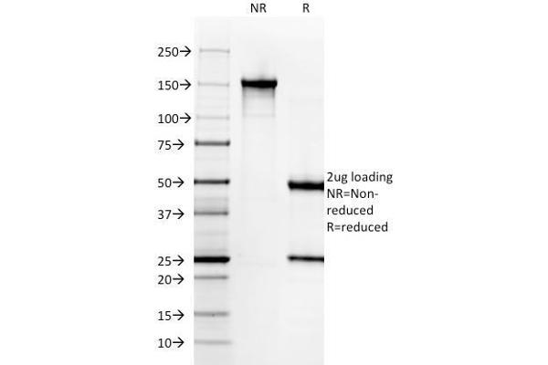 anti-Keratin 6A (KRT6A) antibody