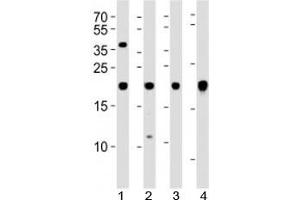 anti-Hairy and Enhancer of Split 5 (HES5) antibody