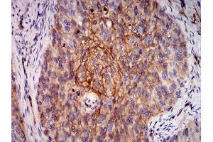 Image no. 7 for anti-V-Ral Simian Leukemia Viral Oncogene Homolog B (Ras Related, GTP Binding Protein) (Ralb) (AA 89-206) antibody (ABIN5542685)
