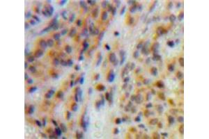 Image no. 3 for anti-DNA Topoisomerase II (TOP2) (AA 923-1148) antibody (ABIN1860829)
