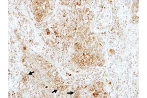 Image no. 2 for anti-RAP1B, Member of RAS Oncogene Family (RAP1B) (Center) antibody (ABIN2855239)