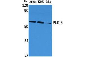 Image no. 2 for anti-Polo-Like Kinase 5 (PLK5) (Internal Region) antibody (ABIN3180825)