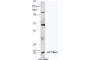Immunofluorescence (Paraffin-embedded Sections) (IF (p)) image for anti-Allograft Inflammatory Factor 1 (AIF1) (AA 51-147) antibody (ABIN685477)