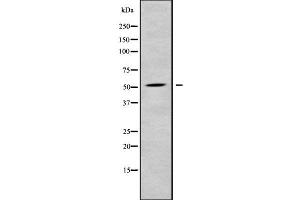 Image no. 1 for anti-RasGEF Domain Family, Member 1C (RASGEF1C) (Internal Region) antibody (ABIN6264649)