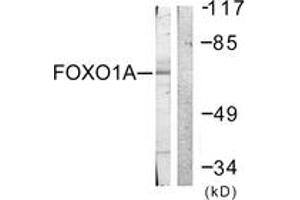 Image no. 1 for anti-Forkhead Box O1 (FOXO1) (AA 295-344) antibody (ABIN1532340)