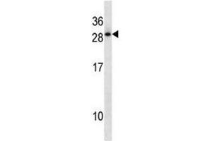 Image no. 2 for anti-Homeobox D12 (HOXD12) (AA 211-237) antibody (ABIN3031252)