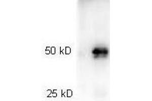 Image no. 1 for Goat anti-Rabbit IgG (Heavy & Light Chain) antibody (HRP) (ABIN964977)