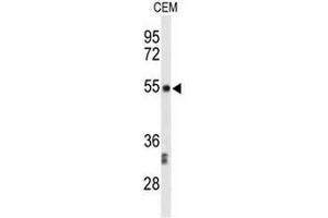 Image no. 1 for anti-Centromere Protein I (CENPI) (Middle Region) antibody (ABIN951467)