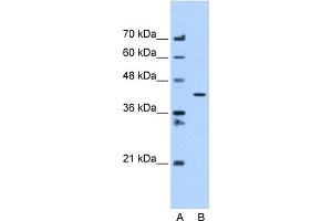 Image no. 1 for anti-Adipocyte Plasma Membrane Associated Protein (APMAP) (C-Term) antibody (ABIN630391)