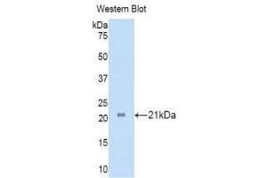Image no. 1 for anti-Interleukin 17 Receptor A (IL17RA) (AA 377-534) antibody (ABIN1859360)