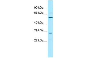 Image no. 1 for anti-Tubulin Folding Cofactor E (TBCE) (N-Term) antibody (ABIN2788890)