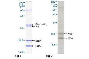 Image no. 1 for serine/threonine Kinase 32C (STK32C) (AA 1-369) protein (GST tag) (ABIN1321692)