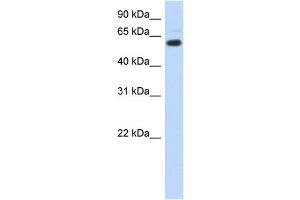 Image no. 3 for anti-Chromodomain Protein, Y-Like (CDYL) (N-Term) antibody (ABIN2783639)