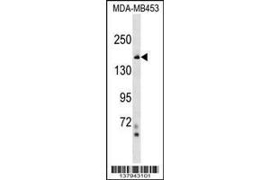 Image no. 1 for anti-Tonsoku-Like, DNA Repair Protein (NFKBIL2) (AA 38-65), (N-Term) antibody (ABIN1539336)