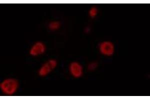 Image no. 1 for anti-Forkhead Box J1 (FOXJ1) (Internal Region) antibody (ABIN6257194)