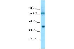 Image no. 1 for anti-Eukaryotic Translation Initiation Factor 3, Subunit D (EIF3D) (N-Term) antibody (ABIN2789124)