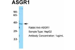 Image no. 8 for anti-Asialoglycoprotein Receptor 1 (ASGR1) (Middle Region) antibody (ABIN2778131)