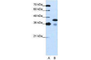 Image no. 4 for anti-TAR DNA Binding Protein (TARDBP) (C-Term) antibody (ABIN2780849)