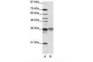 Image no. 2 for anti-T-Cell Leukemia Homeobox 2 (TLX2) (C-Term) antibody (ABIN202158)