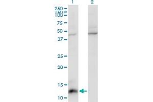 Image no. 2 for anti-Chemokine (C-C Motif) Ligand 7 (CCL7) (AA 24-99) antibody (ABIN520047)
