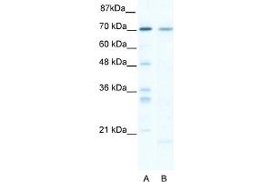 Image no. 1 for anti-SRY (Sex Determining Region Y)-Box 13 (SOX13) (C-Term) antibody (ABIN2778089)