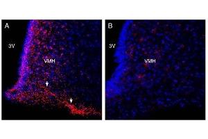 Expression of FFAR4 in rat hypothalamus.