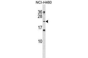 Image no. 2 for anti-Fast Skeletal Troponin I (TNNI2) (AA 1-30), (N-Term) antibody (ABIN952268)