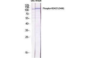 Image no. 2 for anti-Histone Deacetylase 5 (HDAC5) (pSer498) antibody (ABIN3182025)