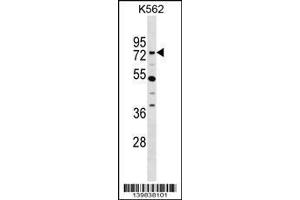 Image no. 1 for anti-Zinc Finger Protein 133 (ZNF133) (AA 144-174), (N-Term) antibody (ABIN1539075)
