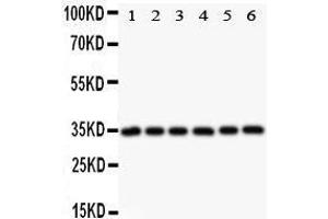 Image no. 1 for anti-V-Crk Sarcoma Virus CT10 Oncogene Homolog (Avian) (CRK) (AA 2-246) antibody (ABIN3042758)