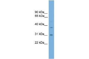Image no. 2 for anti-Aryl Hydrocarbon Receptor Interacting Protein (AIP) (Middle Region) antibody (ABIN2787565)