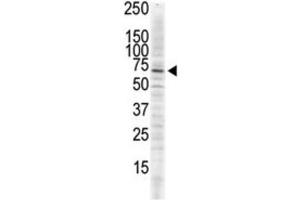 Image no. 3 for anti-Calcium/calmodulin-Dependent Protein Kinase II delta (CAMK2D) antibody (ABIN3003047)