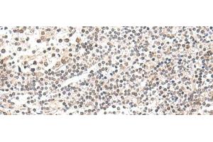 Immunohistochemistry of paraffin-embedded Human tonsil tissue using CKMT1A/CKMT1B Polyclonal Antibody at dilution of 1:55(x200)