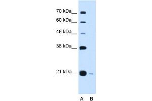 Image no. 1 for anti-DCTP Pyrophosphatase 1 (DCTPP1) (Middle Region) antibody (ABIN2782585)