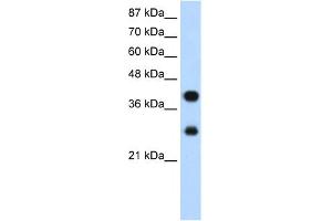 Image no. 1 for anti-Poly(rC) Binding Protein 2 (PCBP2) (Middle Region) antibody (ABIN2778923)