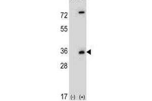 Image no. 7 for anti-Caspase 3 (CASP3) (AA 149-179) antibody (ABIN3030296)