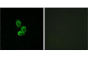 Immunofluorescence analysis of HepG2 cells, using PDGF Receptor beta (Ab-751) Antibody.