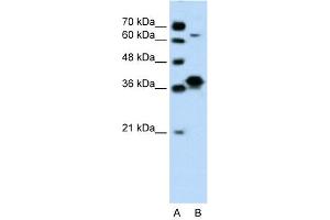 Image no. 6 for anti-FOS-Like Antigen 1 (FOSL1) (Middle Region) antibody (ABIN2777265)