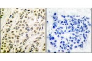 Image no. 1 for anti-Transglutaminase 4 (Prostate) (TGM4) (AA 361-410) antibody (ABIN1533257)