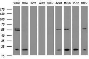 Image no. 3 for anti-NADH Dehydrogenase (Ubiquinone) 1 beta Subcomplex, 9, 22kDa (NDUFB9) (AA 3-179) antibody (ABIN1491361)