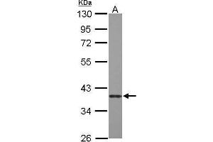 Image no. 1 for anti-Caspase 7, Apoptosis-Related Cysteine Peptidase (CASP7) (Center) antibody (ABIN2855362)