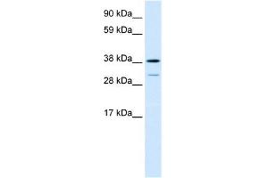 Image no. 1 for anti-Vacuolar Protein Sorting 72 Homolog (S. Cerevisiae) (VPS72) (Middle Region) antibody (ABIN1109499)